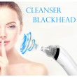 جهاز شفط الرؤوس السوداء